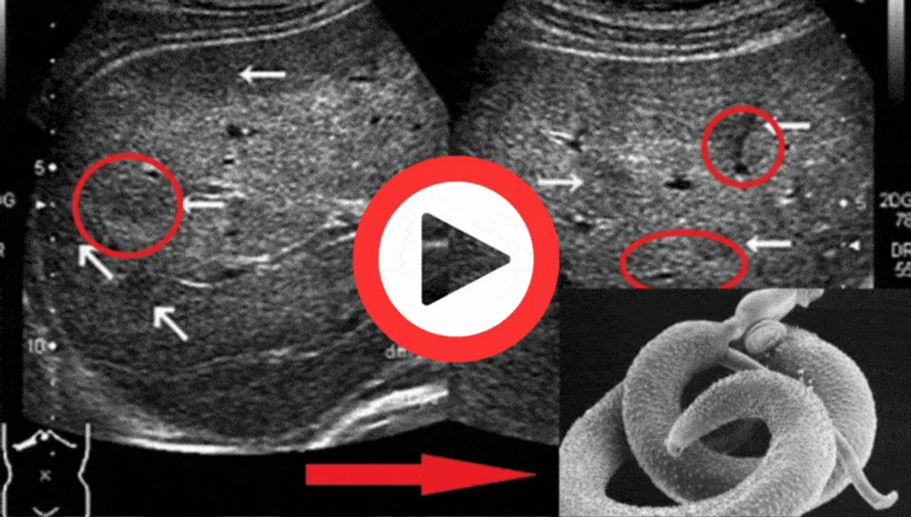 Bloating, Gas, or Constipation? It's Not Your Fault (Watch This)